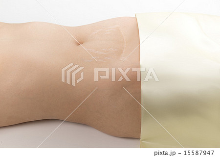 女性腹部の手術痕 15587947