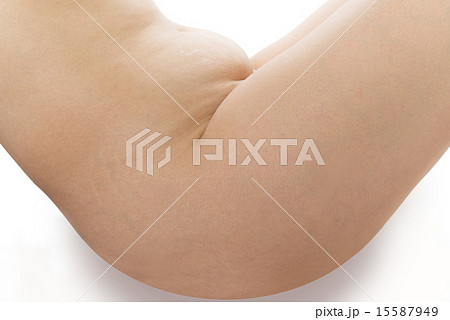 手術痕 15587949