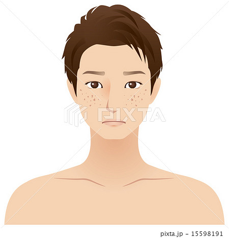 男性 顔 シミそばかすのイラスト素材 15598191 Pixta