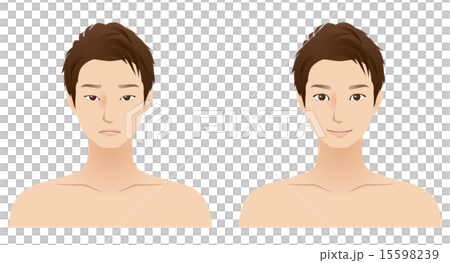 Male face cosmetic surgery dual surgery Male face cosmetic surgery dual surgery 15598239