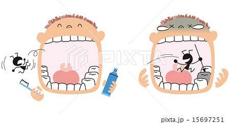歯磨きする男の子と虫歯になる男の子のイラスト素材