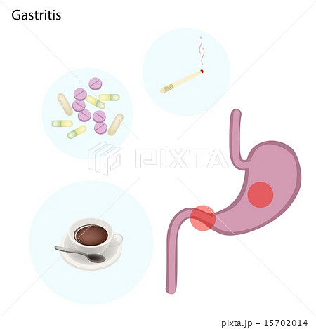 Stomach Disorder Concept on A White Background 15702014