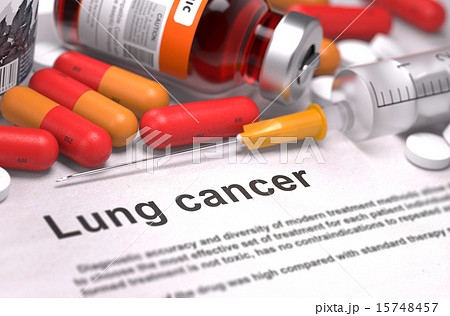 Lung Cancer Diagnosis. Medical Concept.  15748457