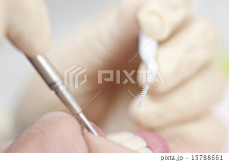 歯科の手元 15788661
