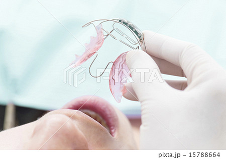 歯科の手元 15788664