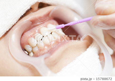 歯科の手元 15788672