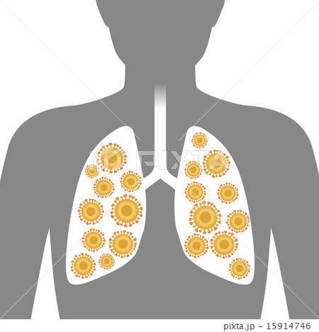 肺とウィルス イメージイラスト 肺とウィルス イメージイラスト 15914746