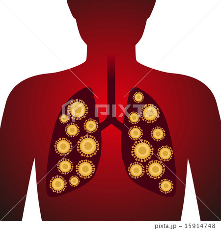 肺とウィルス　イメージイラスト 15914748