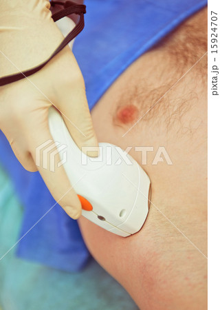 male laser epilation male laser epilation 15924707