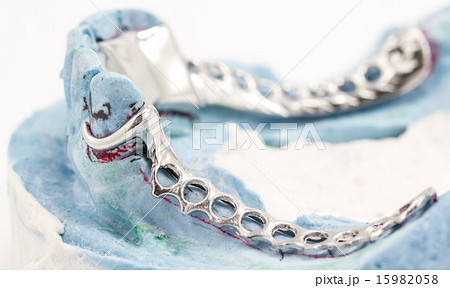 Dental wire bending Dental wire bending 15982058