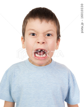 boy with a lost tooth grimacing 16010330