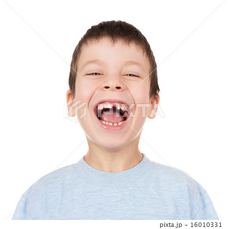 Boy portrait with a lost tooth 16010331