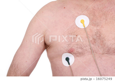 Electrocardiogram Electrocardiogram 16075249