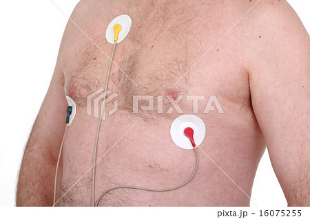 Electrocardiogram 16075255
