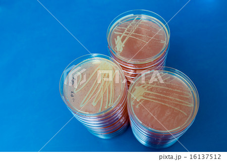 Petri dish with bacteria colonies 16137512
