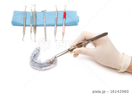Dental prosthesis on gypsum model plaster  16142060