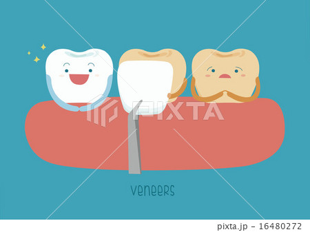 Veneers teeth of dental 16480272