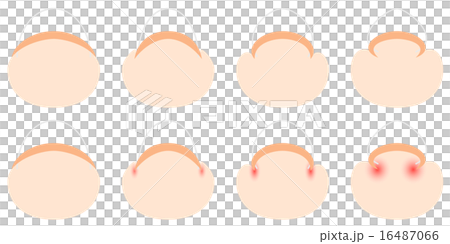 Change of winding nail Change of winding nail 16487066