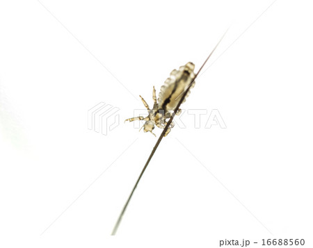 アタマジラミ(生体・髪・裏側) 16688560