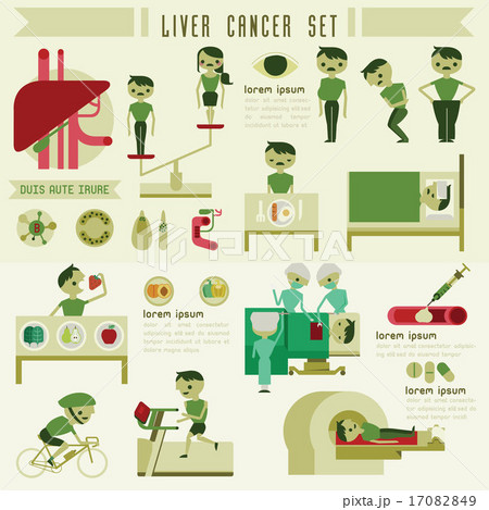 Liver cancer set and info graphic 17082849