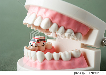 歯の模型 歯の模型 17090493