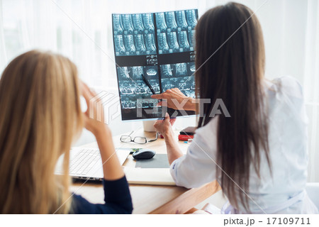 Doctor woman with white labcoat looking at x-ray radiographic results ct scan mri in  hospital 17109711