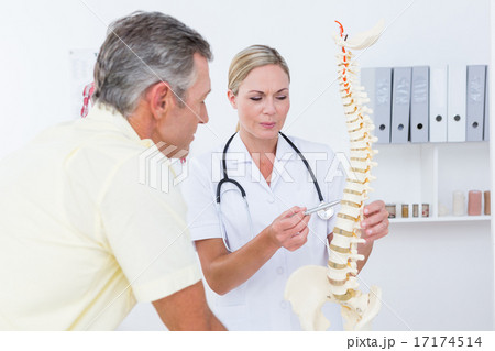 Doctor showing her patient a spine model 17174514
