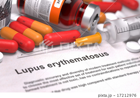 Lupus Erythematosus Diagnosis. Medical Concept. Lupus Erythematosus Diagnosis. Medical Concept. 17212976