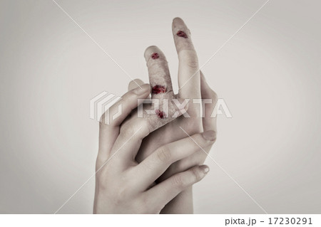 Pain_030 Pain_030 17230291