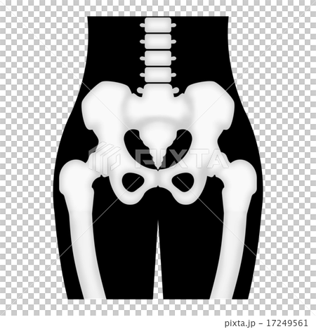 Pelvis and femur 17249561