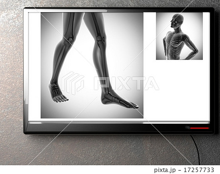 human bones radiography scan image 17257733