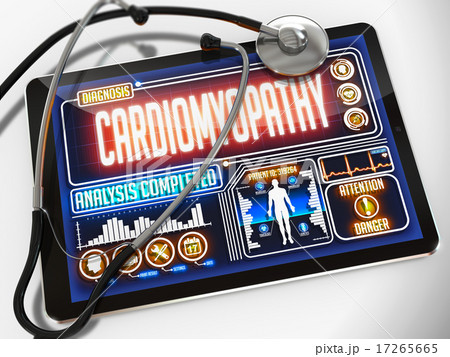 Cardiomyopathy on the Display of Medical Tablet. Cardiomyopathy on the Display of Medical Tablet. 17265665