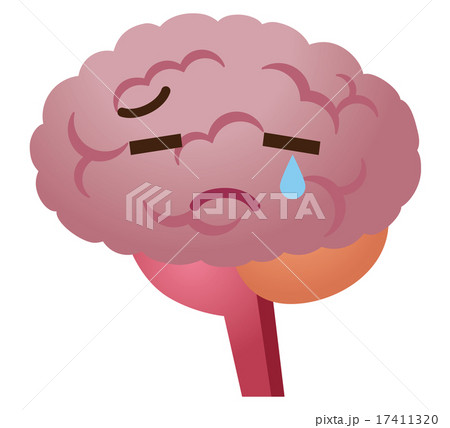 不健康な脳 脳みそ 医療 不健康な脳 脳みそ 医療 17411320