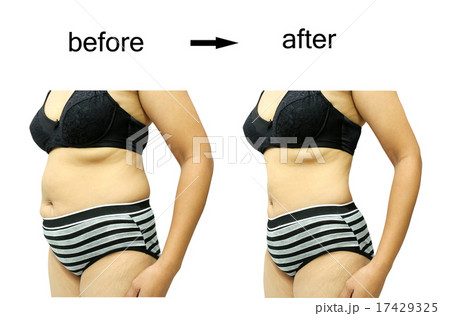 after a diet 17429325