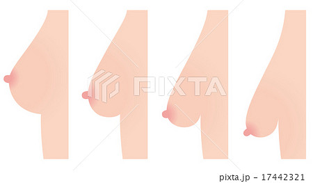 乳房下垂　美容 17442321