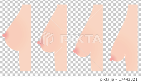 乳房下垂　美容 17442321