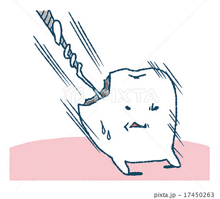 神経を抜かれる歯のイラスト素材