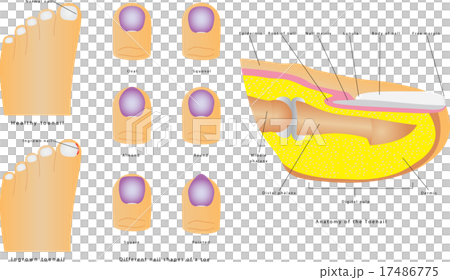 Toenail Toenail 17486775