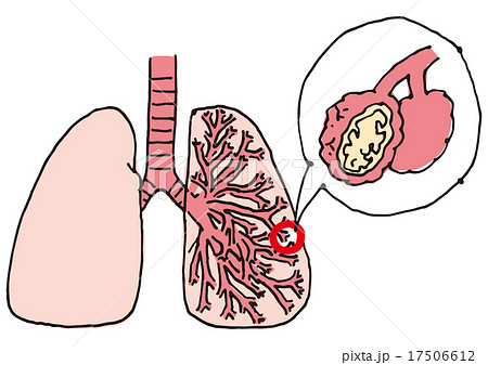 肺の断面図1のイラスト素材