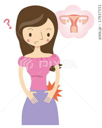 女性特有の病気 17637551