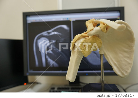 肩MRI 17703317