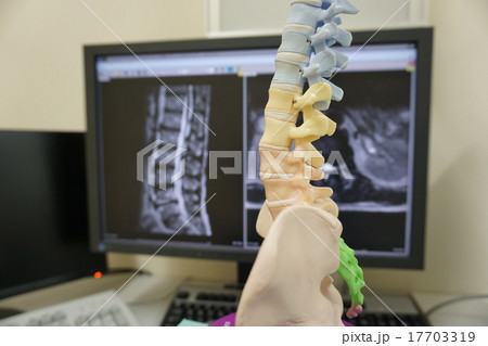 腰椎MRI 17703319