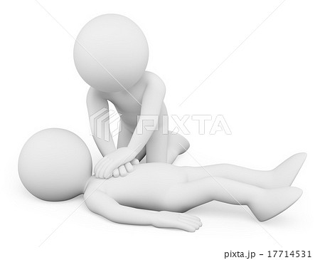 3D white people. Cardiopulmonary resuscitation.CPR 17714531