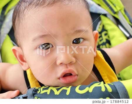 Asian baby with doubtful look on his face 17884512