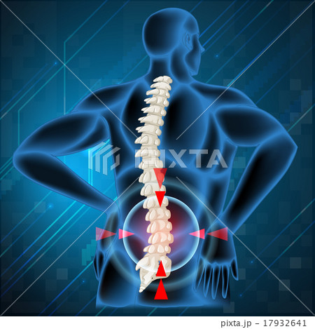 Spine bone showing back pain 17932641