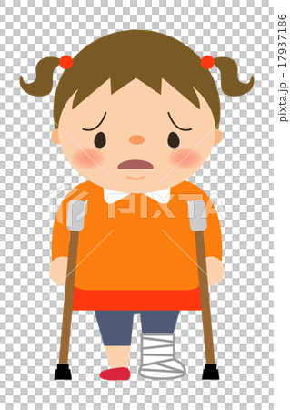 ギプスをした女の子 17937186