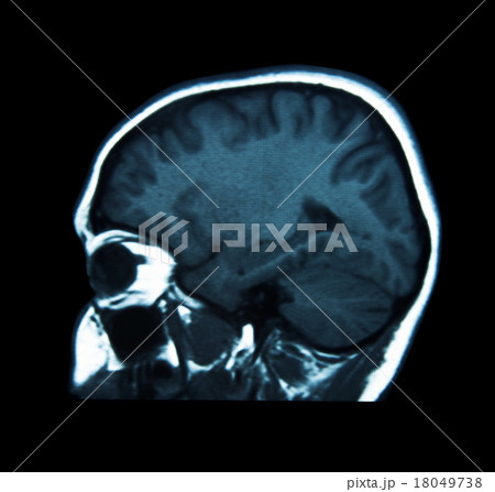 mri scan 18049738