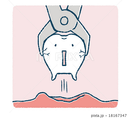 抜かれる歯 抜かれる歯 18167347