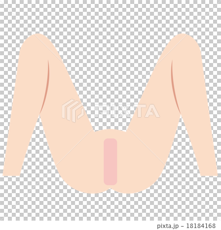 Iライン　脱毛 18184168