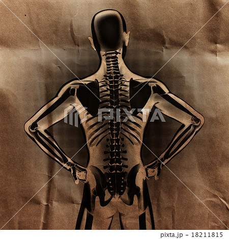 human radiography scan  with bones painted 18211815